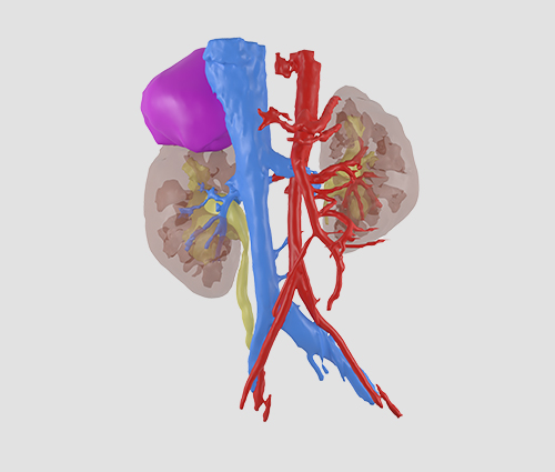 Virtual Surgery Planning (VSP)